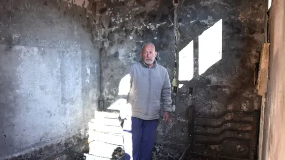 Casi lo peor por dormir sin apagar el cigarrillo