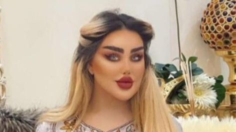Quería parecerse a Barbie y gastó miles de dólares en 43 cirugías estéticas
