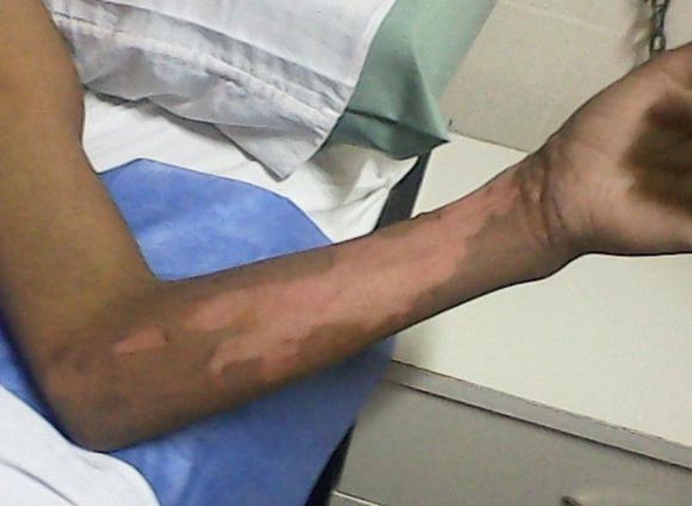 Misterio por 2 niños quemados en los fondos de una bodega
