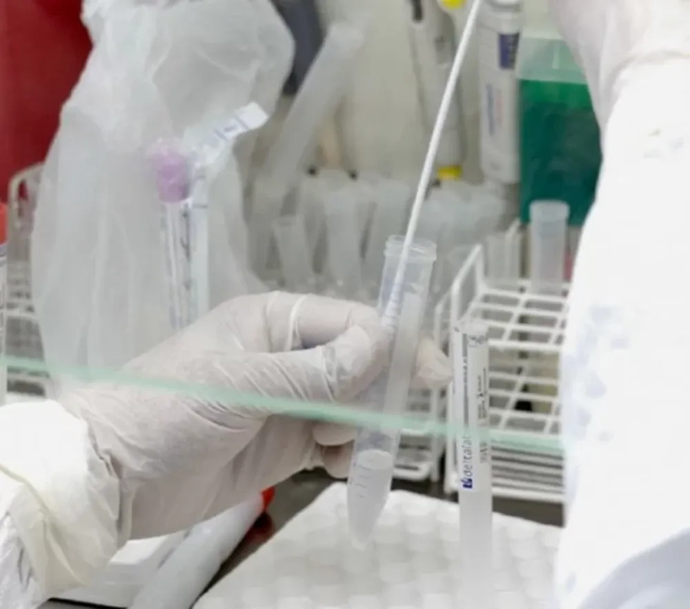 Prueban un aparato que permite tener mucho antes el resultado de los hisopados