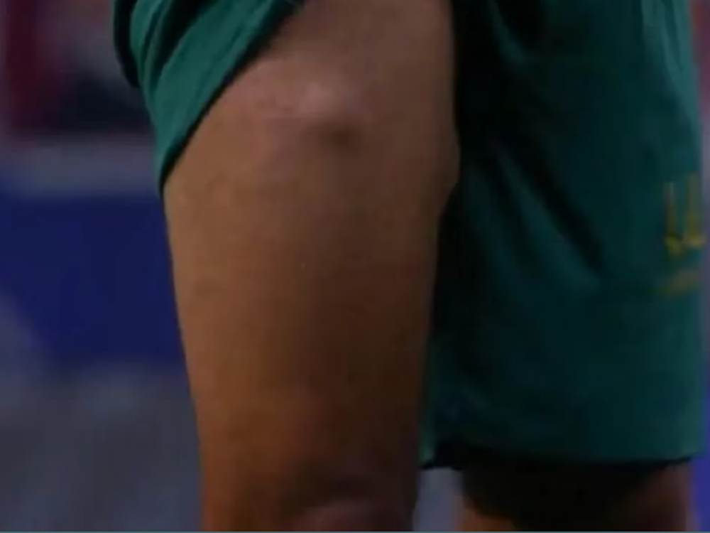 Video: la extraña lesión que sufrió un jugador del Cádiz