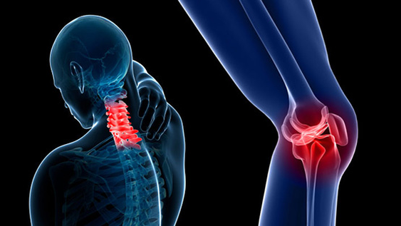 osteoartritis: tres tratamientos potenciales para mejorar el diagnostico, segun una agencia federal