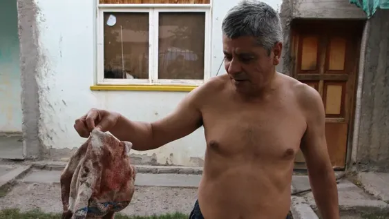 Quiso vengar un robo con un machete, pero se lo quitaron y hasta le fracturaron un brazo