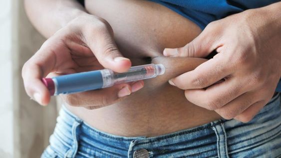 El avance del Ozempic genérico podría transformar el acceso a tratamientos contra la obesidad a nivel global.