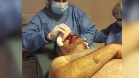 Salvaje agresión a un periodista mientras estaba al aire en una radio de Chaco