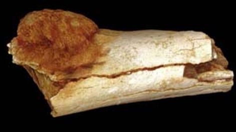 Descubren cáncer en un fósil de un millón de años