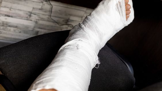 Perdió el control de su moto, cayó y sufrió múltiples fracturas