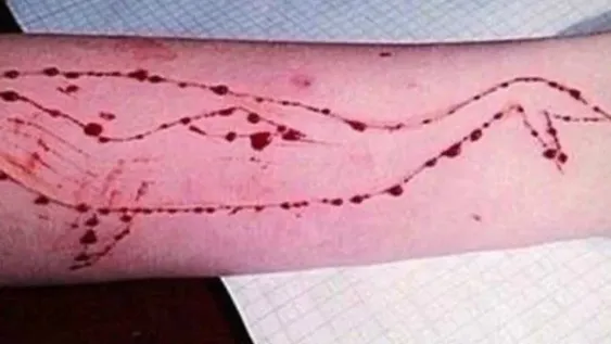 ¿El árbol que tapa el bosque?