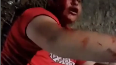 [VIDEO] Golpean ferozmente a un joven que supuestamente robaba a repartidores de comida