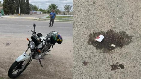 La atropelló una moto, ingresó con una quebradura expuesta de cadera y murió: tenía 79 años