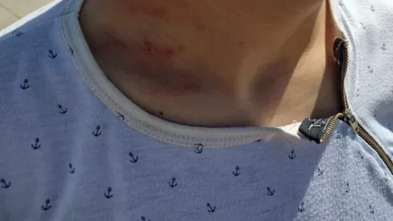 Violencia en el fútbol de inferiores: padres de Zondina golpearon a chicos de Trinidad