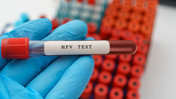 test de hpv gratuito en el parque de mayo: una oportunidad para detectar a tiempo y prevenir el cancer cervicouterino