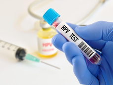 hospitales, caps y cic de san juan seran parte de una campana de test de hpv