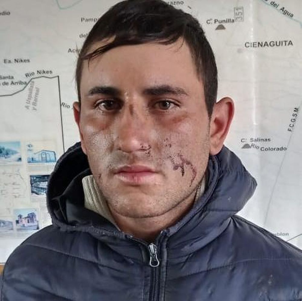 Probation para el sujeto que se lastimó la cara cuando huía en bicicleta de un robo