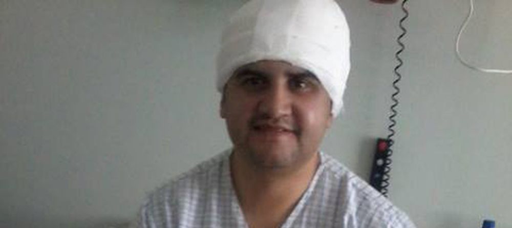 Increíble recuperación de cantante al que le estalló el cráneo en accidente y dijeron que no viviría