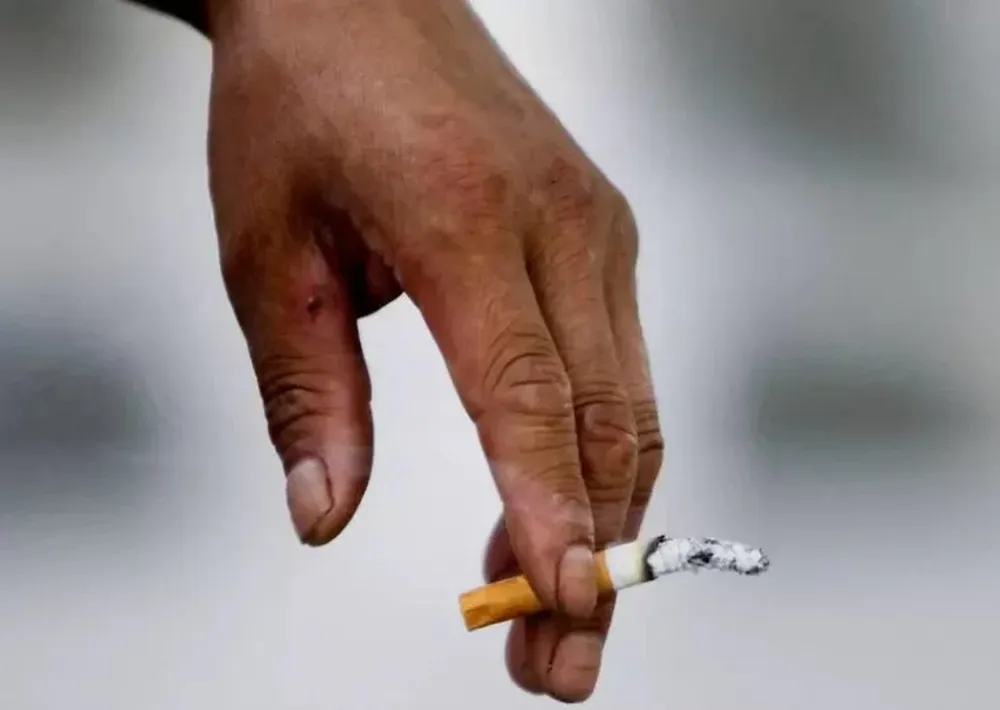 En Francia investigan si la nicotina puede frenar el avance del coronavirus en el cuerpo