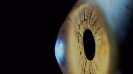 Revelan una nueva secuela del Covid-19 que afecta los ojos