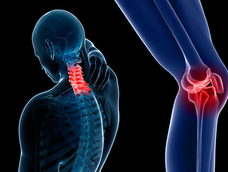 Osteoartritis: tres tratamientos potenciales para mejorar el diagnóstico, según una agencia federal Osteoartritis: tres tratamientos potenciales para mejorar el diagnóstico, según una agencia federal