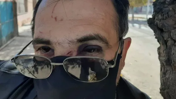 Entran dos a su taller, lo atacan a golpes y lo fracturan, ¿fueron a robar o por venganza?