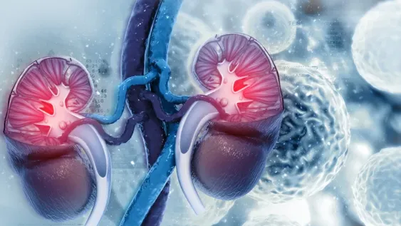 Se diagnostican 5.000 casos de cáncer renal por año en Argentina