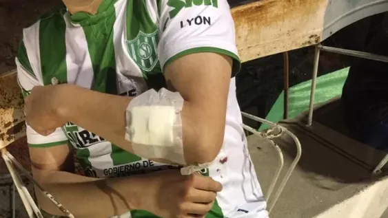 Un perro de la Policía mordió a un hincha de Sportivo y tuvieron que hacerle 8 puntos