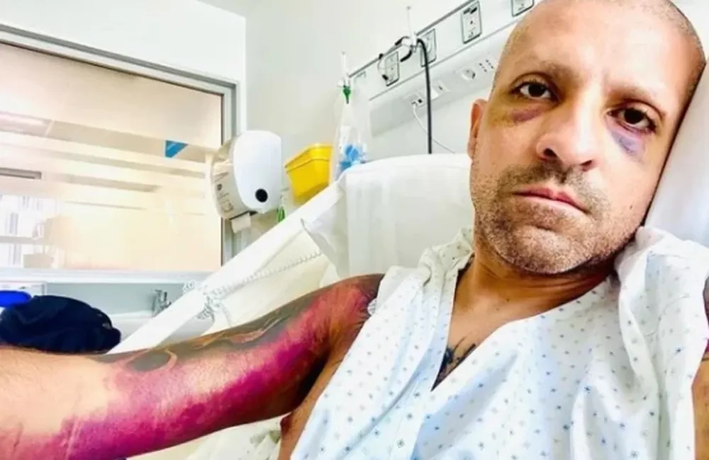 Escándalo en Chile: un político confesó que mintió al decir que tenía cáncer