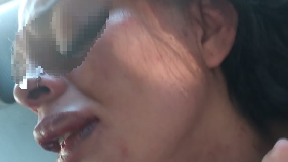 Mujer atacada por su ex con un destornillador: “Me dijo que me despidiera de mis hijas”