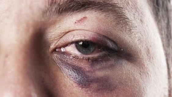 Un joven se animó a contar que su novia lo golpeaba y a pedir asistencia