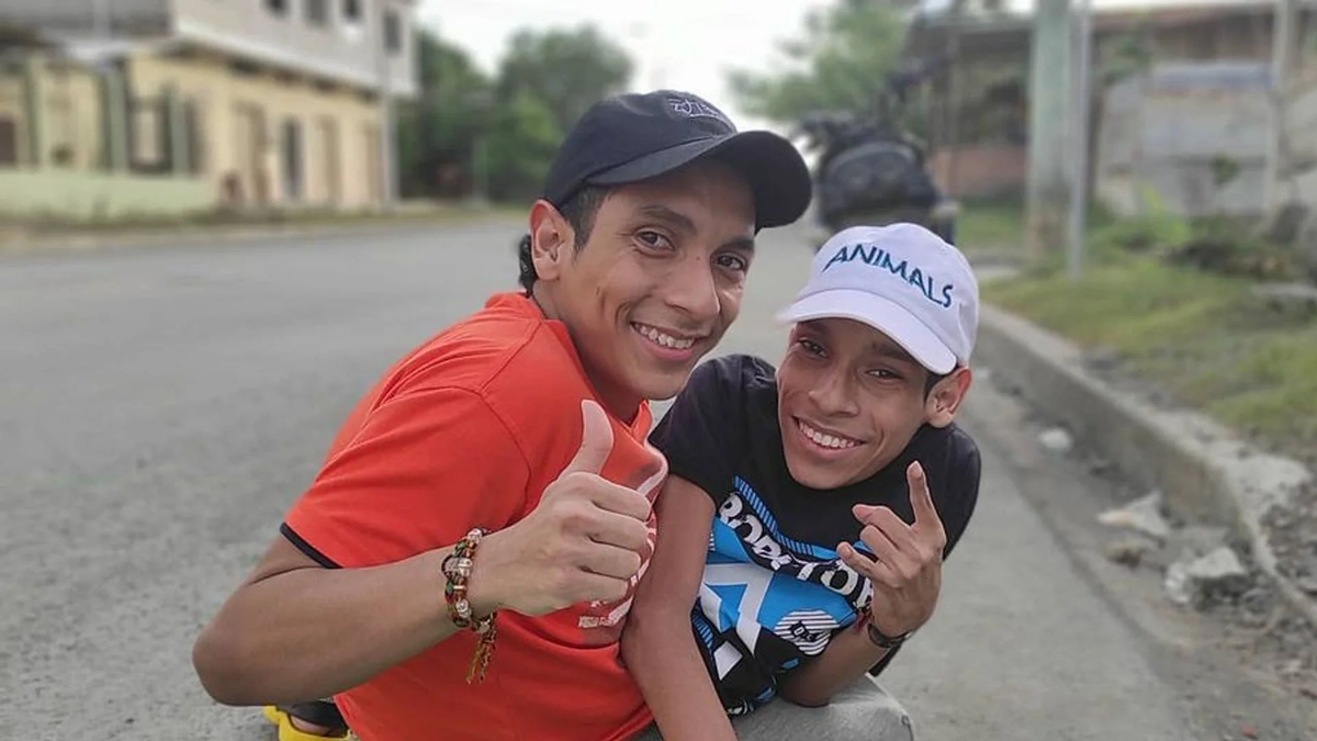 "Nacimos juntos y moriremos juntos": la trágica historia de los siameses que cumplieron su promesa