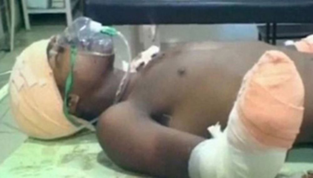 Un hombre le cortó las manos al violador de su beba