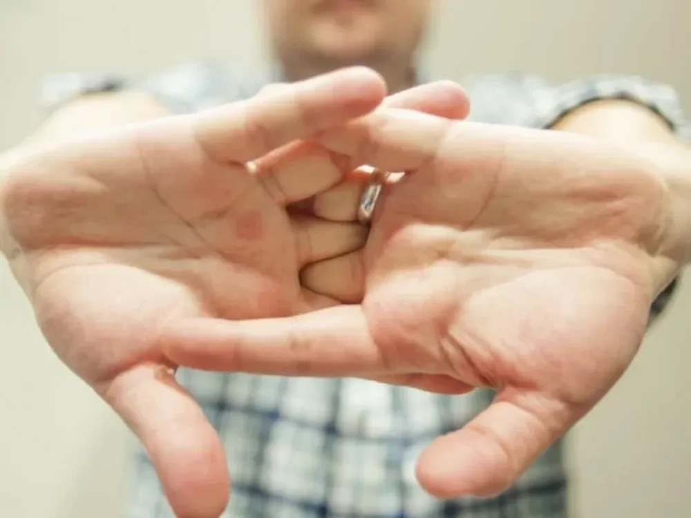 Sonar los dedos de las manos, las deforma: ¿mito o verdad?