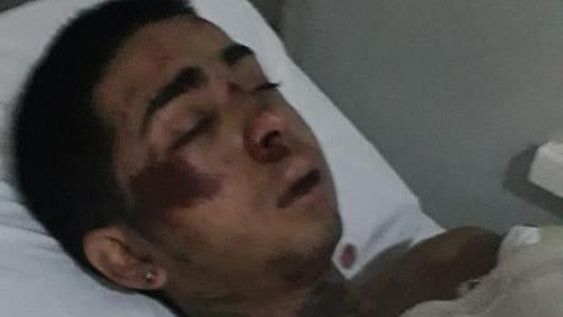 Golpearon en patota hasta dejar inconsciente a un joven de 18 años y lo tiraron a una pileta