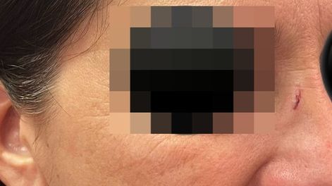 Tras la agresión, la directora sufrió hematomas en la cara y un corte por los anteojos que tenía puestos.