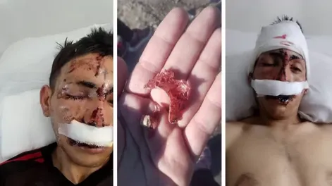 Salvaje ataque: dos hermanos golpearon a un joven hasta desfigurarlo frente a su hijo de 7 años