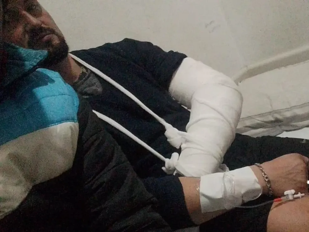 [VIDEO] Una mujer baleó a su ex yerno porque lo cree culpable de la muerte de su hijo