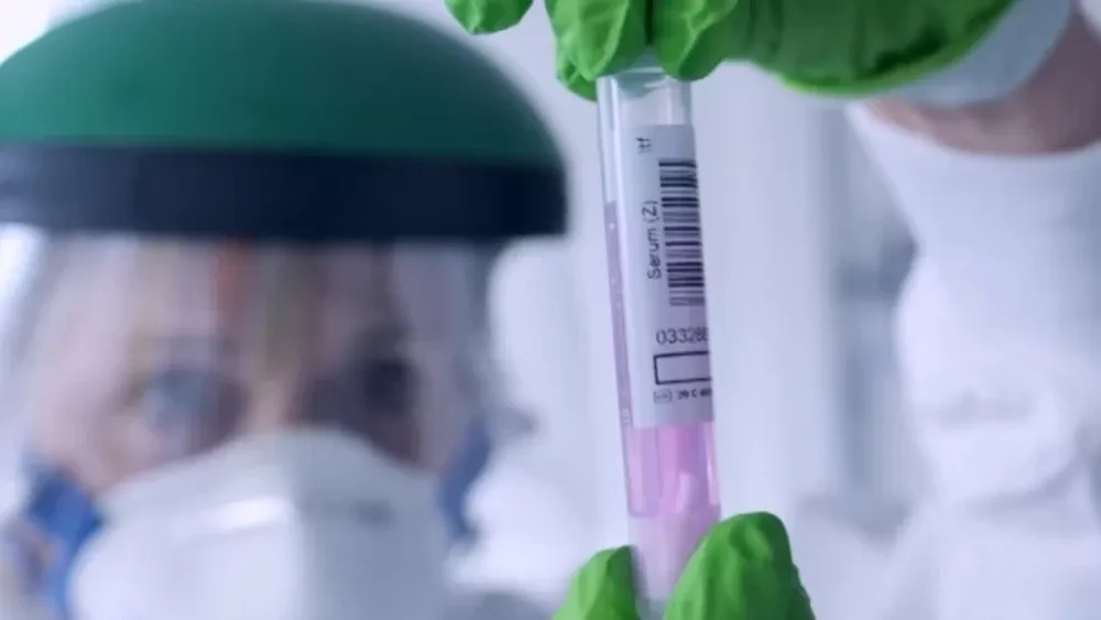 Italia espera vacunar contra el coronavirus a casi 2 millones de personas en enero: qué marca usará