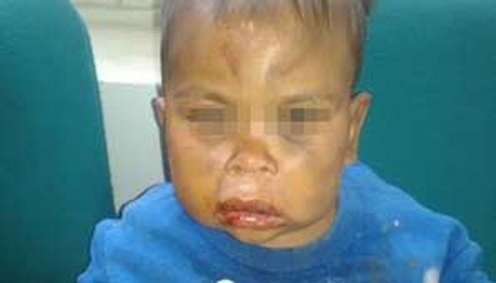 Un hombre golpeó brutalmente a su pequeño hijo