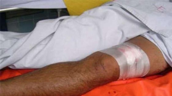 En 13 horas, 2 personas debieron ser hospitalizadas luego de ser mordidas por perros