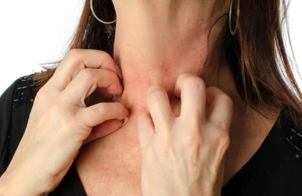 Cuáles son las cinco enfermedades más comunes del verano y cómo cuidarse