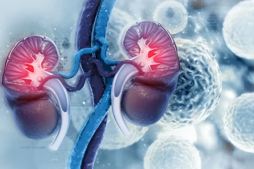 Se diagnostican 5.000 casos de cáncer renal por año en Argentina