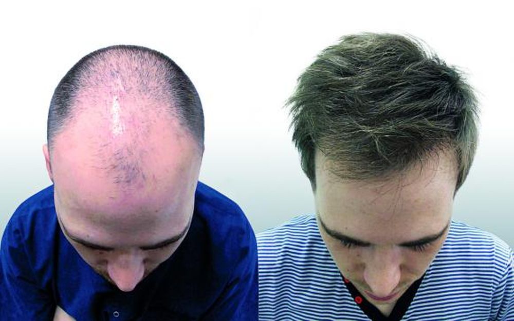 Cabezas al pelo