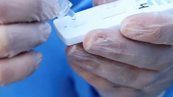 Aseguran que el test rápido de venta libre en las farmacias todavía no genera interés
