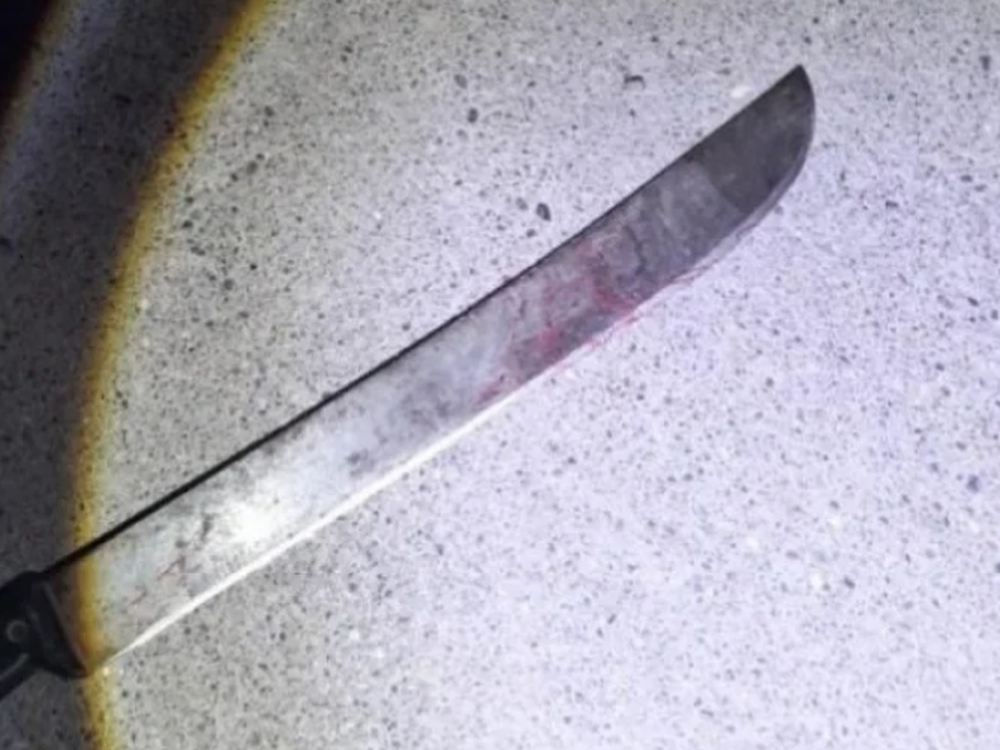 Encontró a un ladrón en su casa y le amputó varios dedos a machetazos
