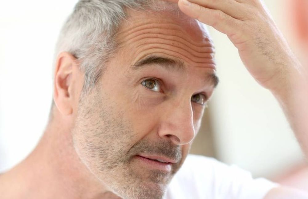 La razón por la que el estrés hace que salgan canas