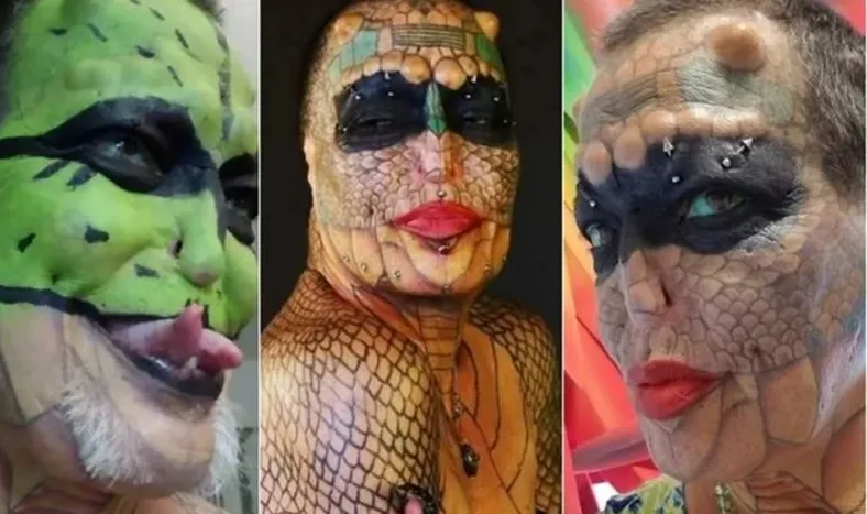 Se extirpará los genitales para completar la transformación a “dragón sin género”