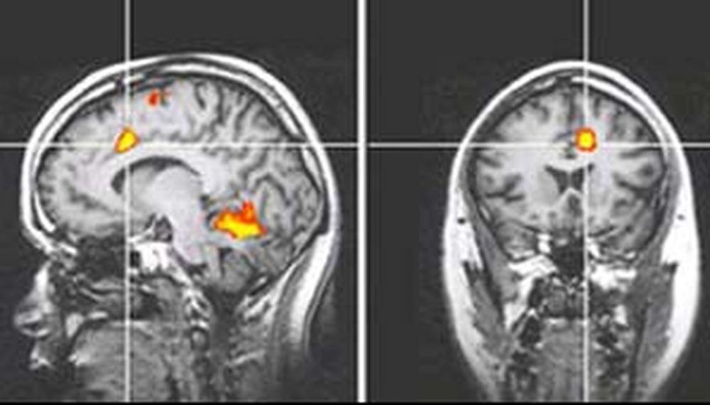 Crean detector del dolor