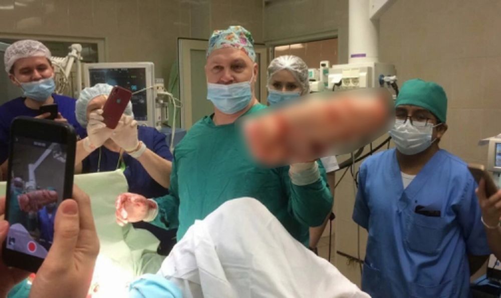 Fue al hospital por un dolor intenso y le extrajeron un consolador enorme del abdomen
