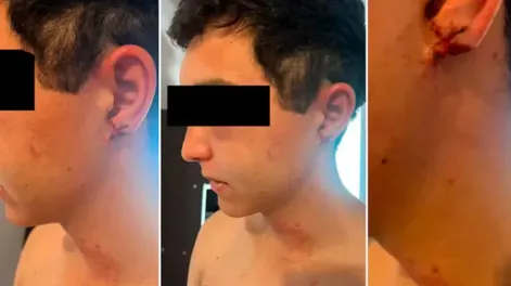 La gravísima denuncia de un trabajador rural torturado por sus jefes: “Me sacaron la oreja con los dientes”