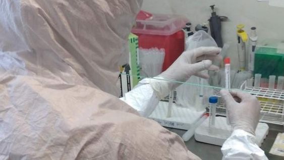 Argentina recibió 250.000 test PCR para diagnosticar el coronavirus