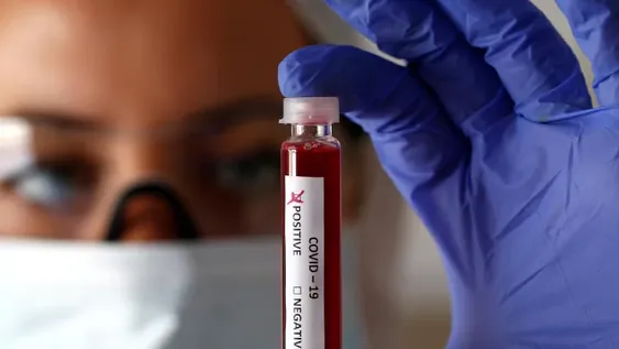 Covid-19: confirman 34 nuevas muertes y 2.606 contagios en las últimas 24 horas en el país